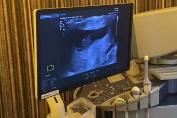 Monitor z obrazem ultrasonograficznym ciąży na ekranie w gabinecie lekarskim