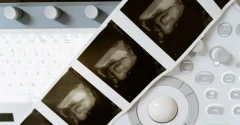 USG 3D a 4D – czym różnią się obrazy i co można na nich zobaczyć?